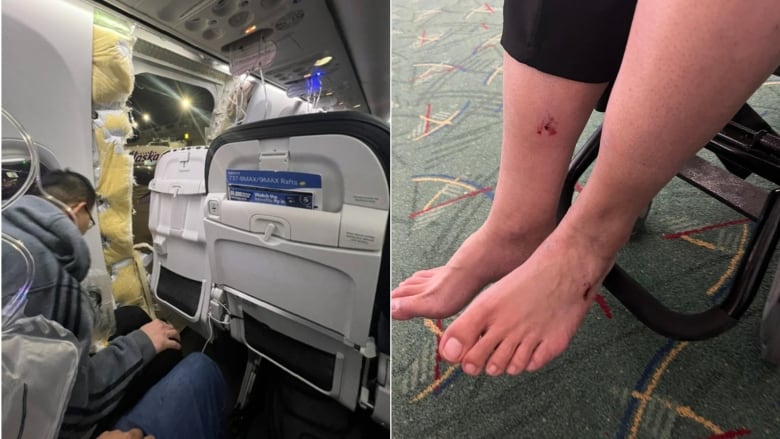 Two pictures, side-by-side. On the left, a man is pictured from behind on a plane, hunching over in his seat, just behind a gaping, rectangular hole in the side of the plane.  On the right a close up his bare feet, both cut and one swollen. 