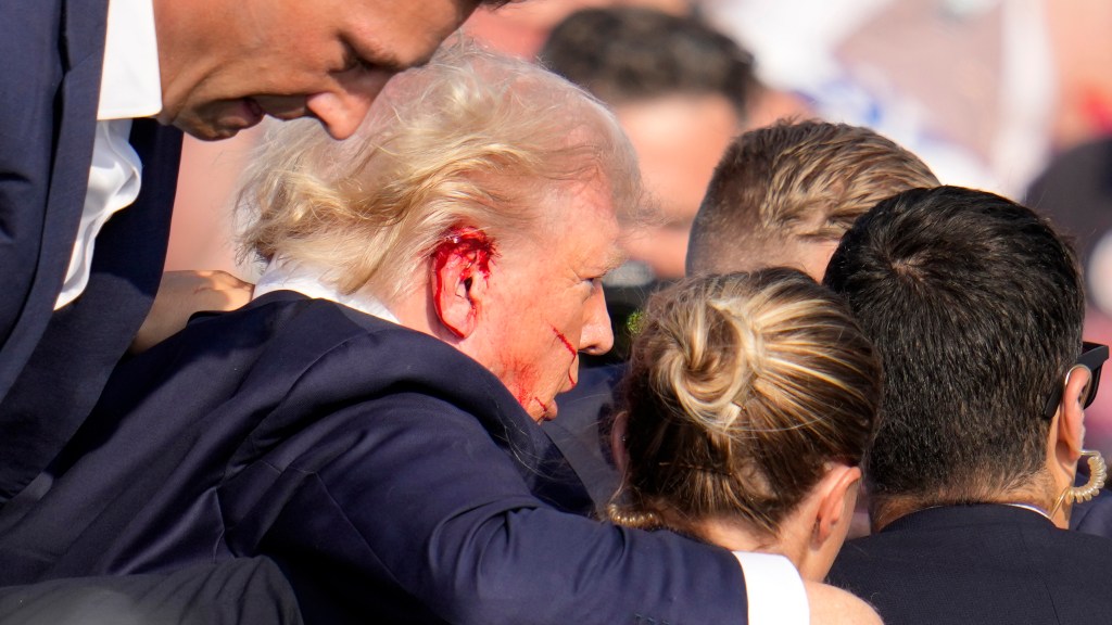 FBI questions whether Trump's ear was actually hit by bullet
